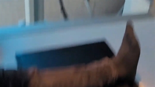 عملکرد سیستم رادیولوژی به همراه دستگاه CR