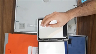 انواع کاست های تصویربرداری