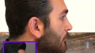 عمل های جذاب بینی مردان