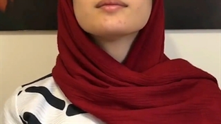 این همه تغییر ؟؟؟ قبل و بعد جراحی بینی