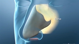 بهترین جراح بینی تهران