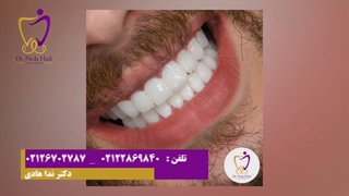 کامپوزیت دندان