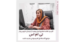 کاربرد نقشه مغزی قبل و بعد درمان دارویی تی ام اس