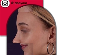 عمل بینی تهران