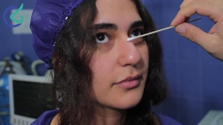 قبل و بعد یه بینی کاملاا استخوانی و افتاده