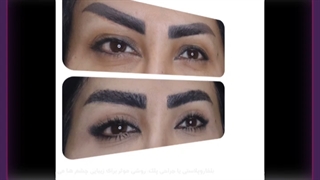 پف چشم