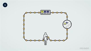 الکتروکوتر و نحوه کار آن