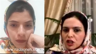 لایو  زردی نوزاد با دکتر سونا اسلام پور (متخصص اطفال و فوق تخصص نوزادان) بخش سوم