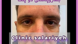 آیا عمل پف چشم ضرر دارد ؟