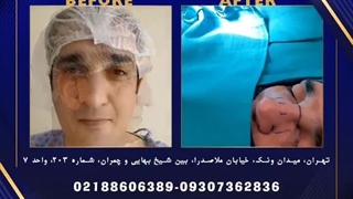 جراحی ترمیم بینی