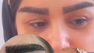 بهترین کلینیک کاشت ابرو در تهران | پارمیدا