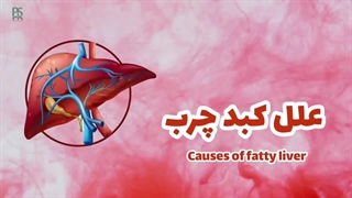 رازهای تشخیص کبد چرب بدون سونوگرافی