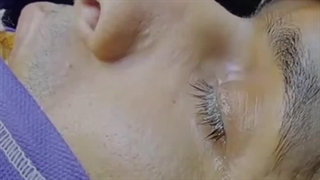 فیلم عمل بینی مردانه در بروجرد