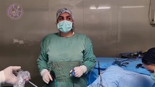 برداشتن رحم به روش لاپاراسکوپی