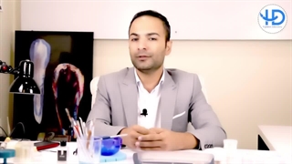 روند تهیه‌ اسنپ اسمایل چگونه است؟