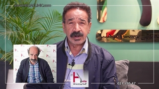 تحولی شگفت‌انگیز در 10 ماه: رضایت بی‌نظیر پس از کاشت مو در کلینیک هلیا