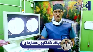 بلاک گانگلیون ستاره ای