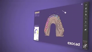 نرم افزار اگزوکد 2024 ورژن Dental CAD EXOCAD 3.2 لایسنس | دنتانا Denttana