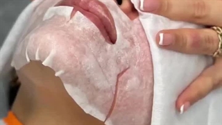 فیشال در سولا دکتر پوست
