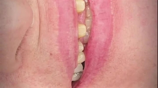 دکتر مهدی کچوئی پوسیدگی دندان