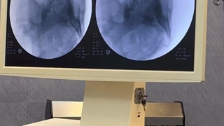 عصب کشی صورت ،دکتر امیر علی اورندی فوق تخصص درد کلینیک درد مهرگان.