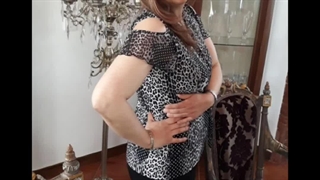 سرقت دکتر مرضیه میرعنایت لیپوساکشن